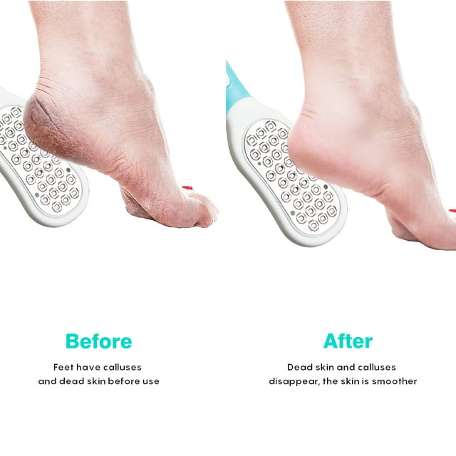 Kit de 5 Pcs Râpe de pédicure professionnelle - الصورة 5